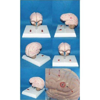 Brain Epilepsy Model